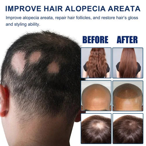 South Moon Alopecia Areata  Clean Scalp Supple Frizzy Hair Wash And Care Gift Set